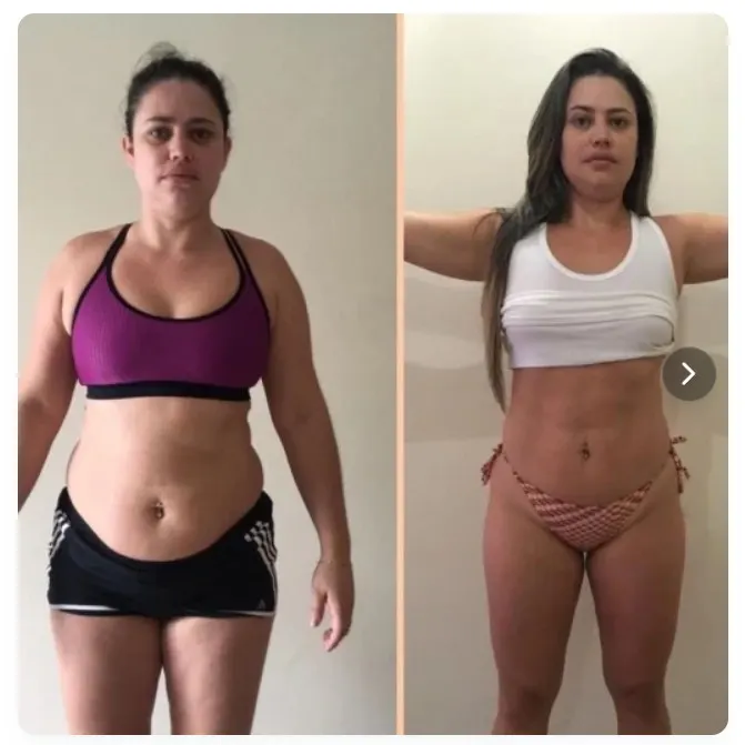 Antes e depois de Juliana Almeida