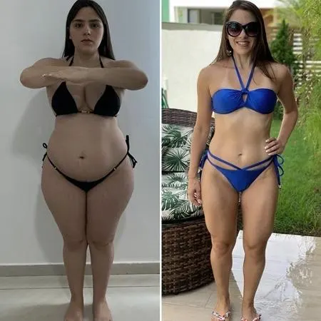 Antes e depois de Solange Ferreira