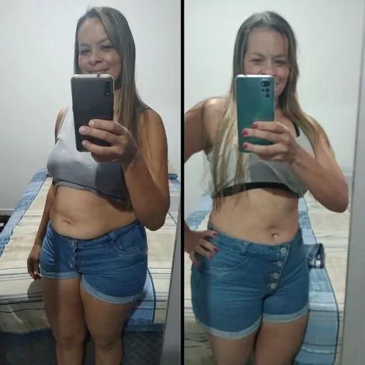 Antes e depois de Patrícia Mendes